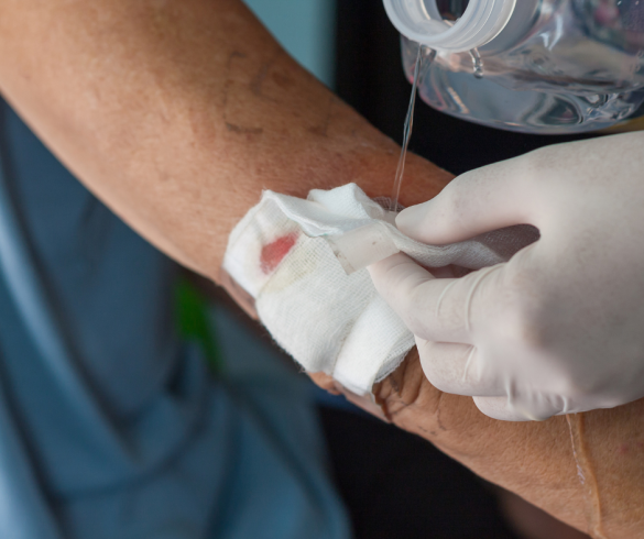 Woundcare
