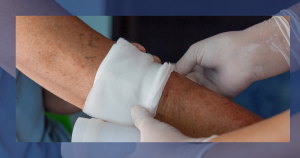 Wound Care Reimbursement Clarity
